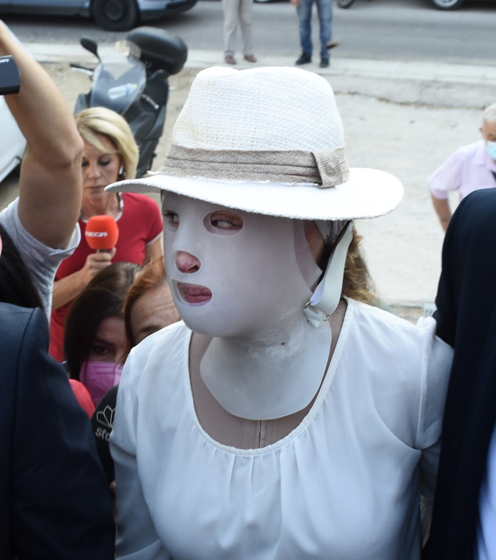Επίθεση με βιτριόλι – Ιωάννα Παλιοσπύρου: Η 36χρονη την παρακολουθούσε από το καλοκαίρι του 2019