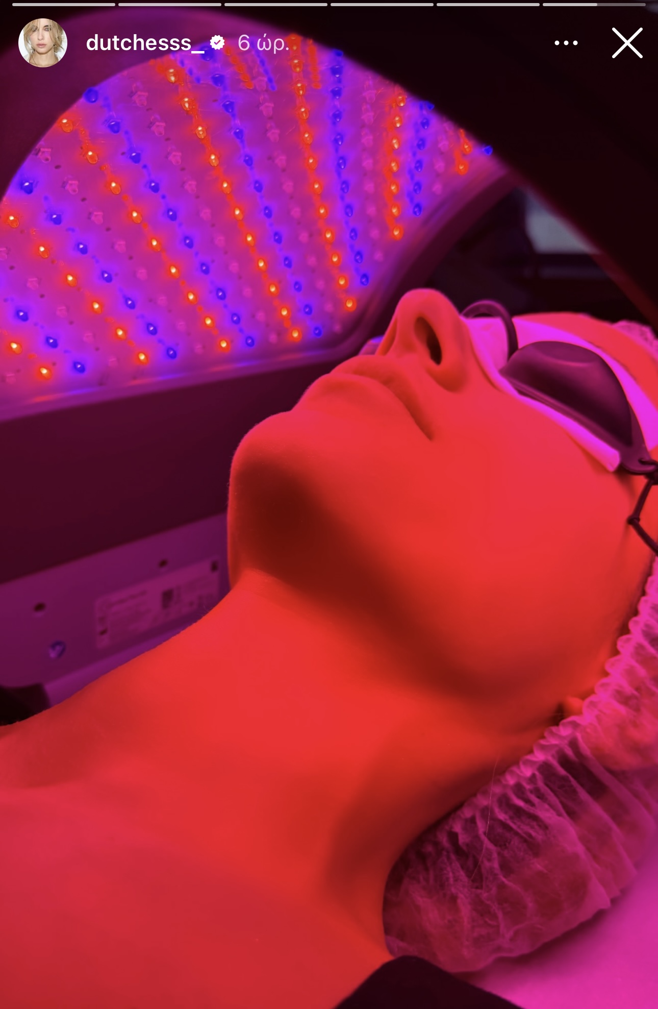 Η Δούκισσα Νομικού με led μάσκα